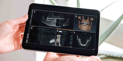 Praxen - Kieferorthopädie: Knirscherschiene - Augsburg - 3D-Implantologie  - Zahnarztpraxis am Zeugplatz - Zahnarzt Augsburg