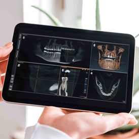 Praxis: 3D-Implantologie  - Zahnarztpraxis am Zeugplatz - Zahnarzt Augsburg